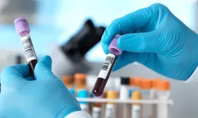 Exámenes completos de Glucosa + Colesterol + Triglicéridos ¡Inicia una vida saludable!