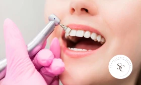 Kit Preventivo Dental: Consulta Odontológica, Limpieza y Destartraje Profesional