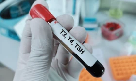 Examen de tiroides: perfil tiroideo con TSH, T4 libre y T3 total