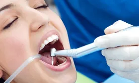 4 curaciones de alta estética con resina 3M + historia clínica